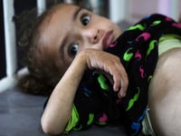 Gaza’s main hospital is overwhelmed with children in pain from malnutrition