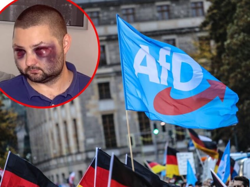 german populist politician brutally beaten in alleged migrant attack