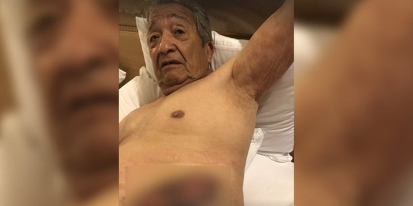 grandpa 81 attacked by disneyland security dog lawsuit