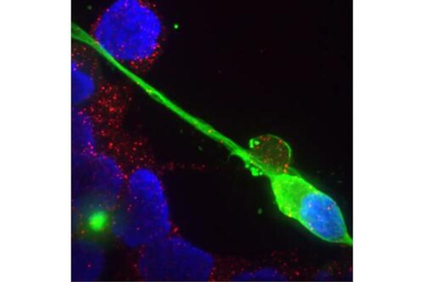 gut instinct cause for numerous sensory symptoms in long covid doctors offer comprehensive treatment