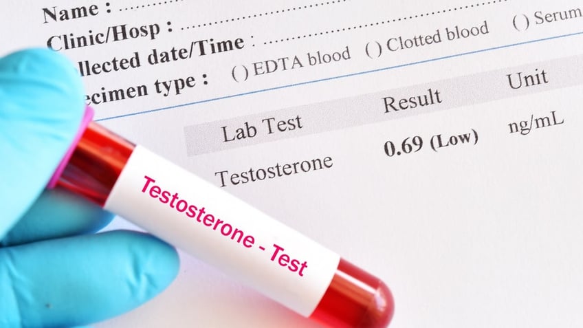 Testerone