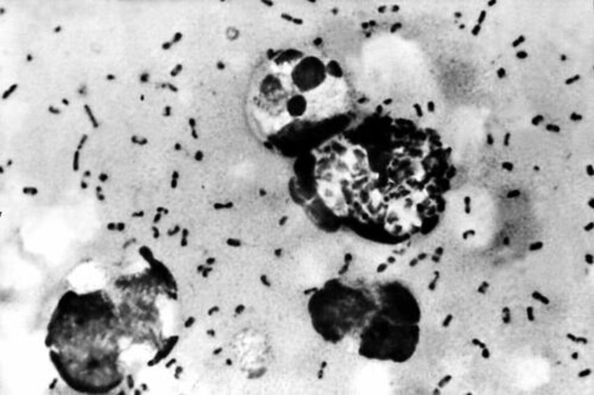 health officials man dies from bubonic plague in new mexico