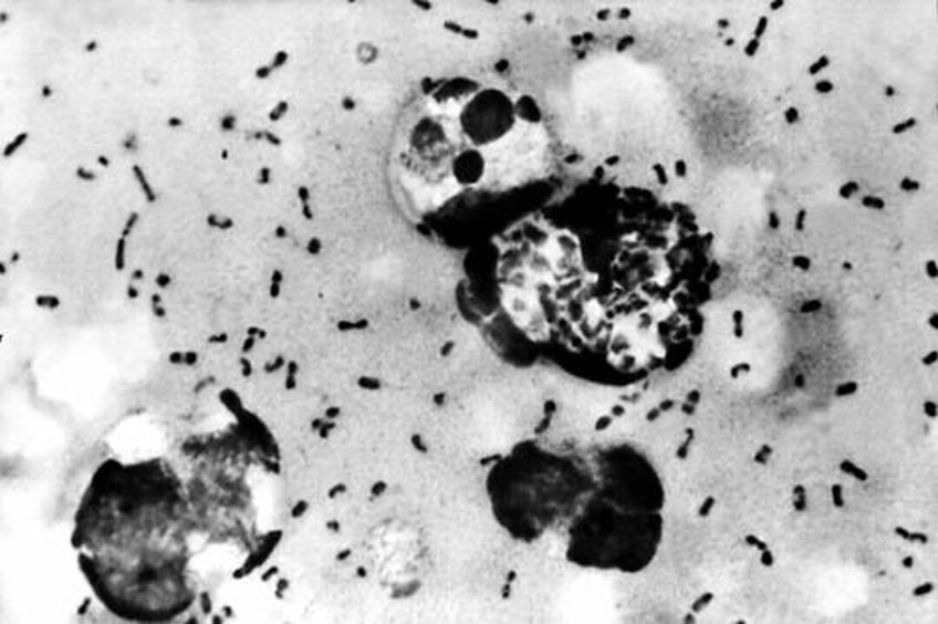 health officials man dies from bubonic plague in new mexico