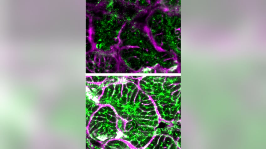 Failing and repaired heart cells