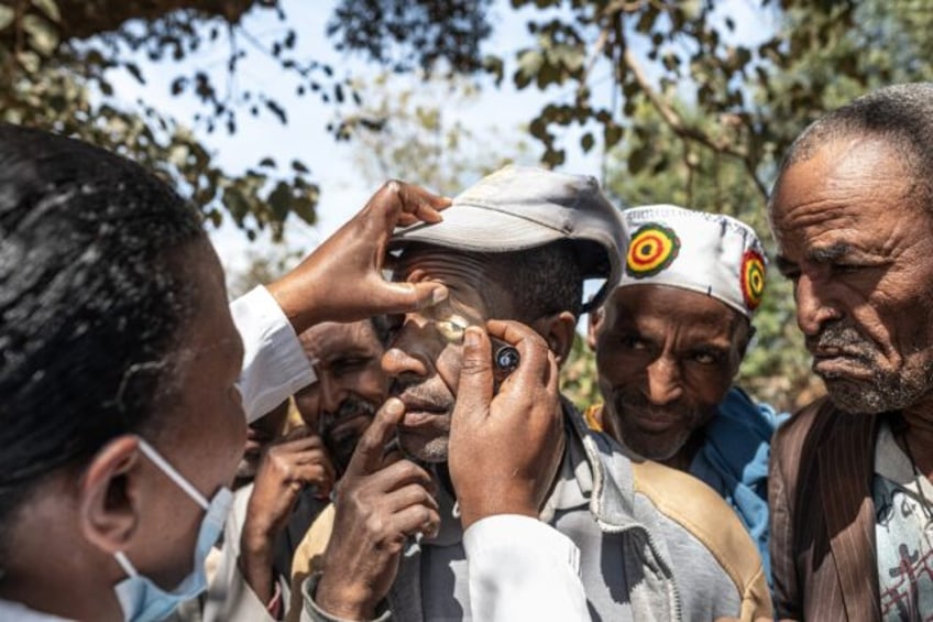 Check-ups for trachoma in a village community near Butajira