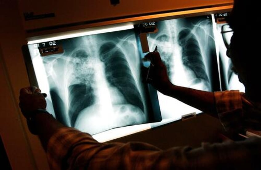 illegal immigrant children with tuberculosis released across us