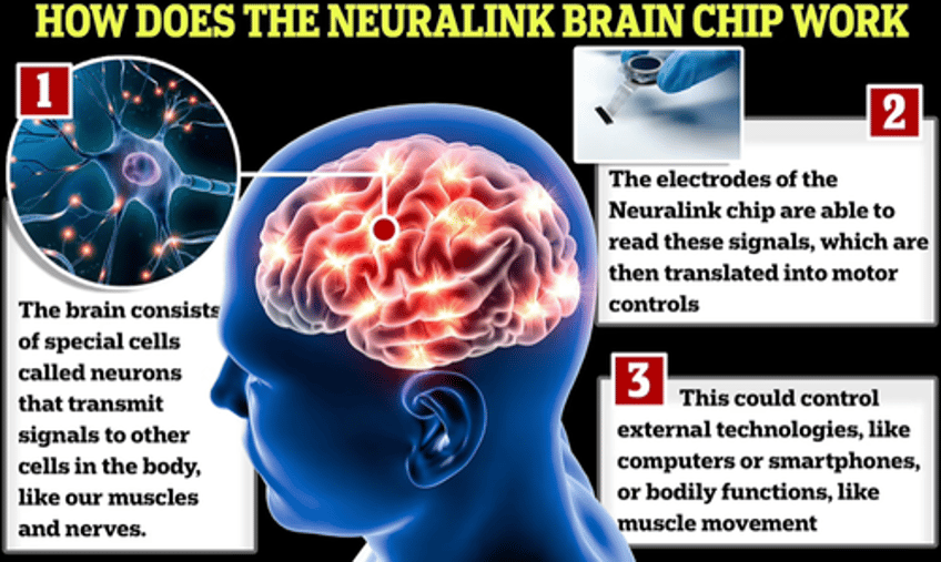 im using the force musks brain chip allows paralyzed man to play civilization vi 