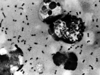 In Colorado, plague case confirmed in human, health officials say: ‘Must be treated promptly’