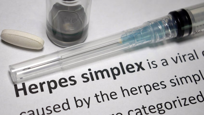 Herpes Simplex paperwork with injection