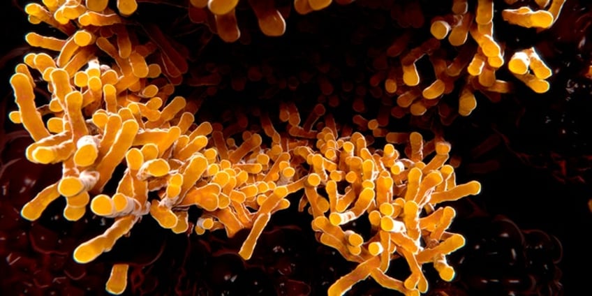 indiana hospital notifies around 500 patients they may have been exposed to tuberculosis