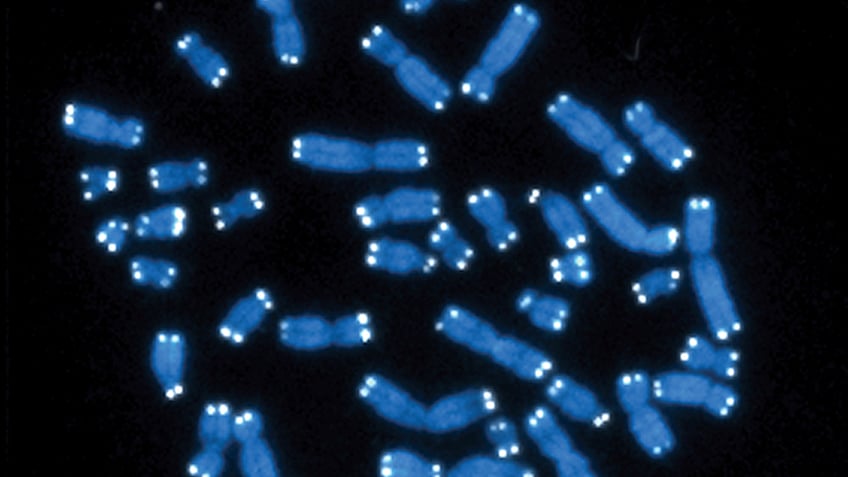 Chromosomes