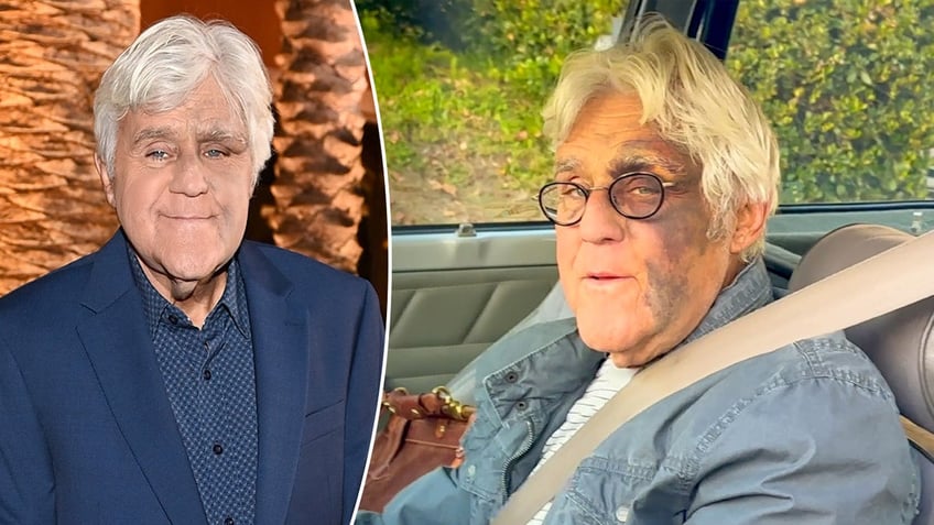 Comedian Jay Leno was heavily bruised following a fall.