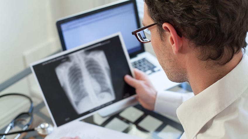 doctor checking x-ray of lungs