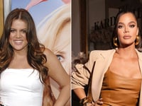 Khloé Kardashian reveals every cosmetic procedure she's ever done
