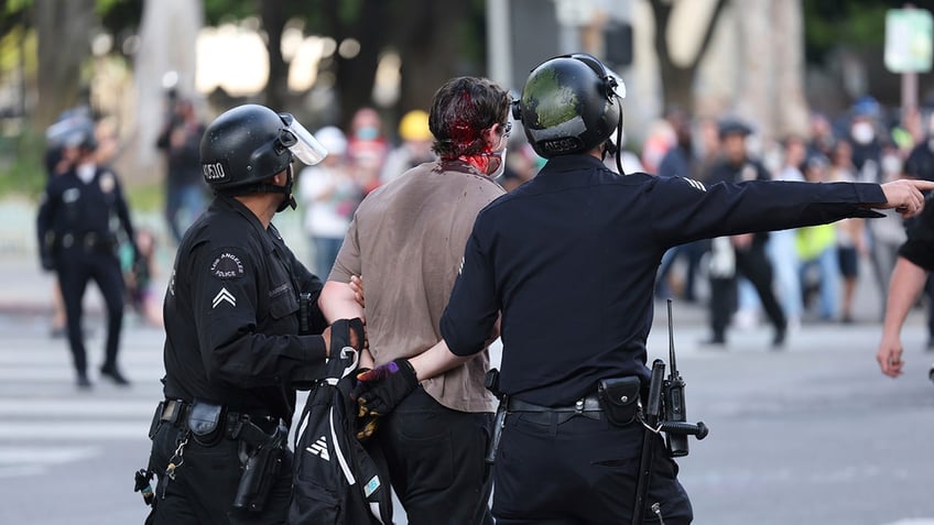 Bloody man arrested in Los Angeles