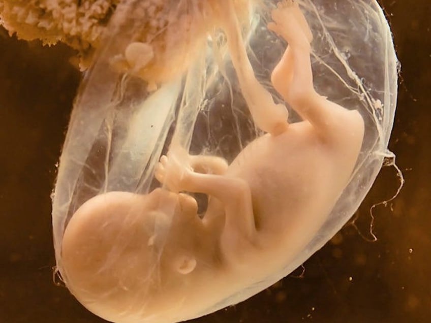 Fetus in Utero