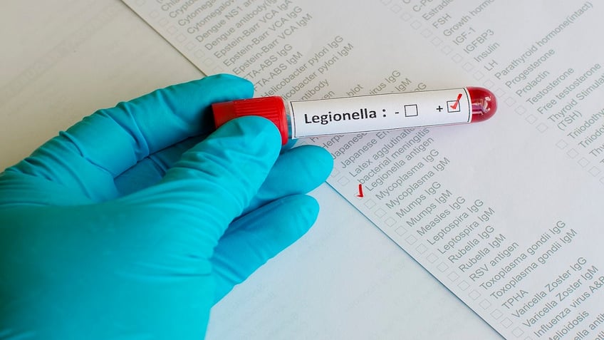 Legionella bacteria