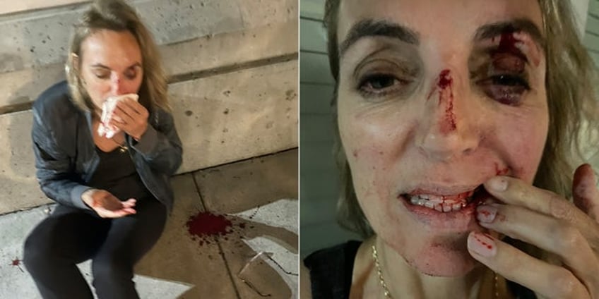 liberal portland leaders face backlash over homeless mans attack on doctor slow response from police