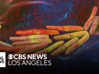 Long Beach Declares Public Health Emergency Due to ‘Surprising’ Tuberculosis Outbreak