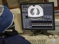 Lung cancer risk in never-smokers predicted by AI tool ‘Sybil’
