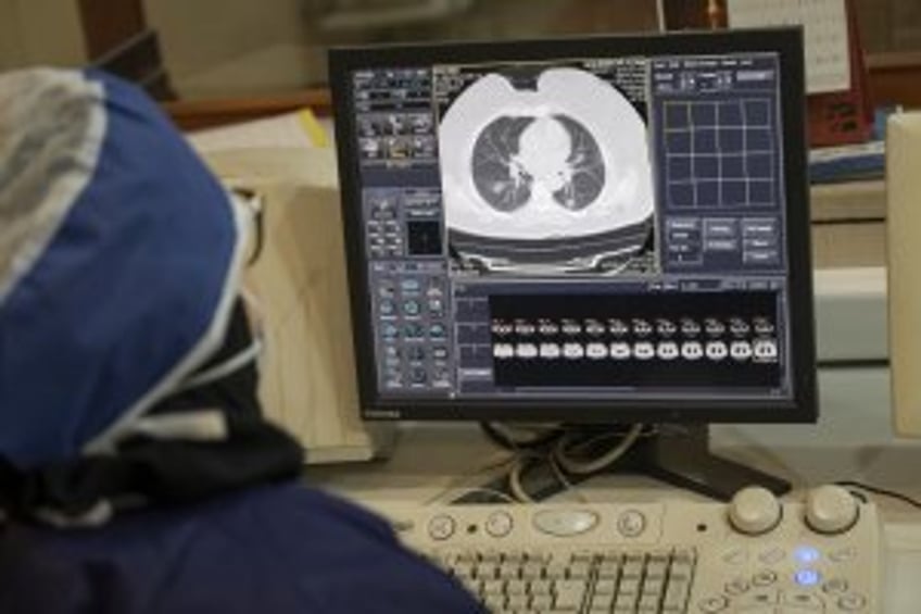 Lung cancer risk in never-smokers predicted by AI tool 'Sybil'