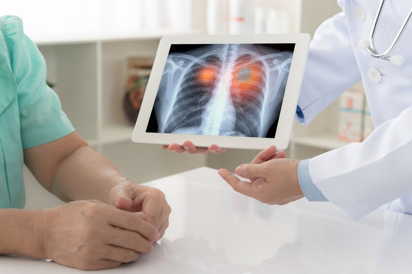 lung cancer types symptoms and treatment options