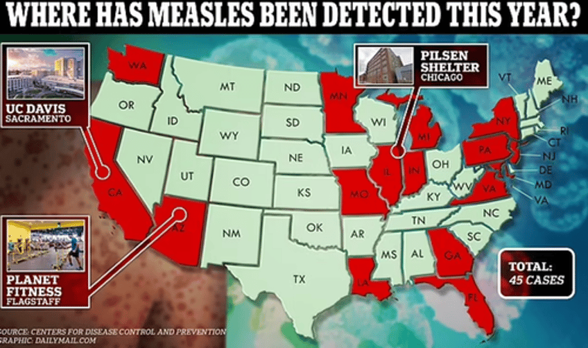 major measles outbreak reported in us as migrant shelters become infectious disease breeding grounds