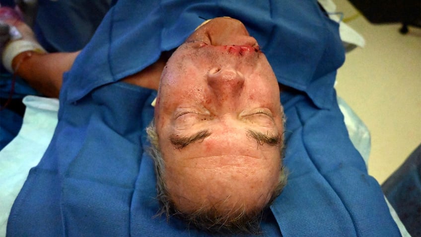 man who survived grizzly attack bears message for beast after surgery gives him new face