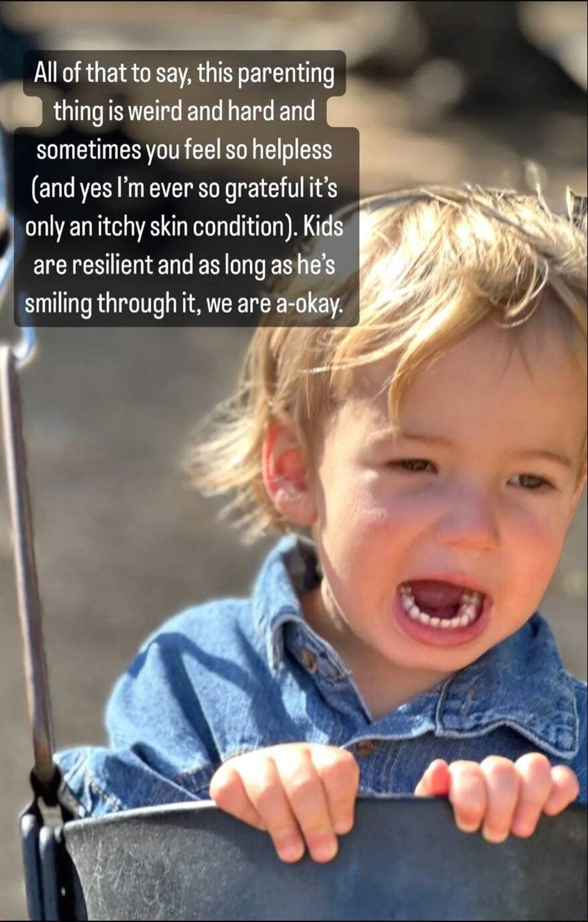 mandy moore reveals that her son gus 2 has gianotti crosti syndrome sometimes you feel so helpless