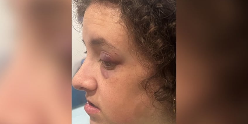 maryland special needs woman mocked assaulted by group on rockville bus police