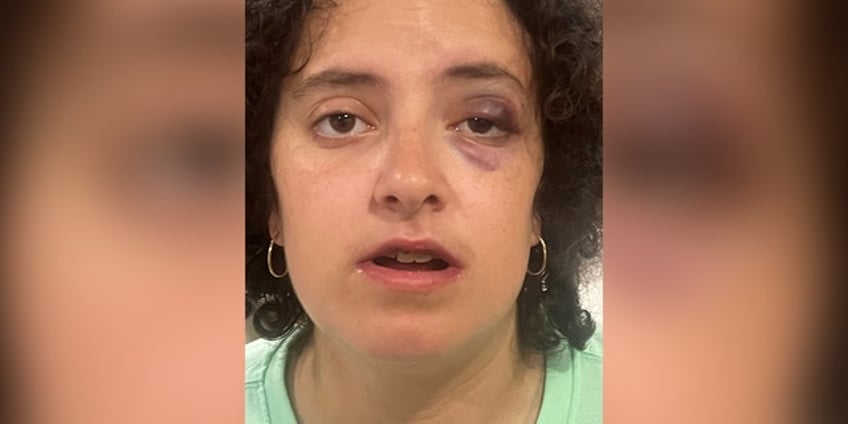 maryland special needs woman mocked assaulted by group on rockville bus police