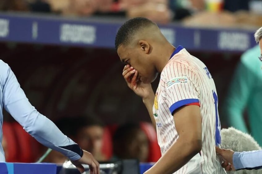 Kylian Mbappe comes off with a bloodied nose at the end of France's win over Austria in Du