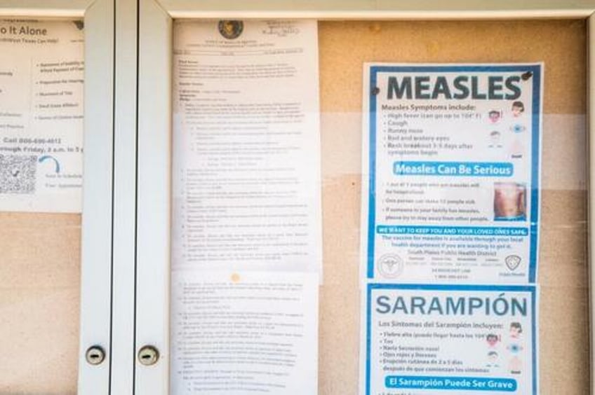 measles outbreak likely bigger than thought cdc