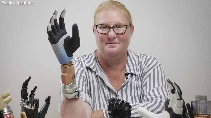 meet the first person ever to receive a fully functional bionic hand with ai