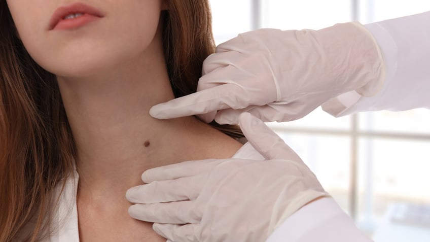 melanoma patients reveal dramatic stories for skin cancer awareness month i thought i was careful