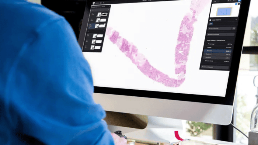 microsoft and paige partner to create worlds largest ai model for cancer detection unprecedented scale