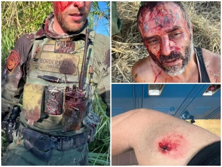 Border Patrol Agent Assaulted in New Mexico (Photos: U.S. Border Patrol via Myra Flores Va