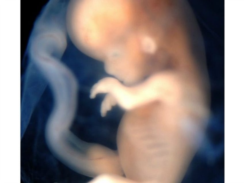 minnesota no longer reports number of infants born alive in botched abortions