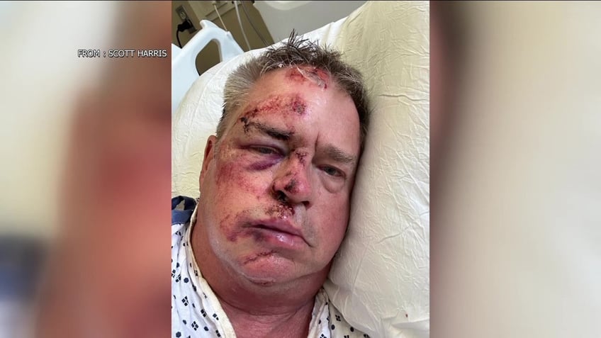 navy vet brutally mugged in philadelphia while walking his dog gets 100 stitches