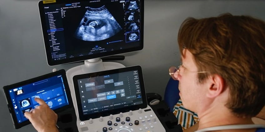 new ai ultrasound tech is first to land fda approval to enhance prenatal care better health outcomes