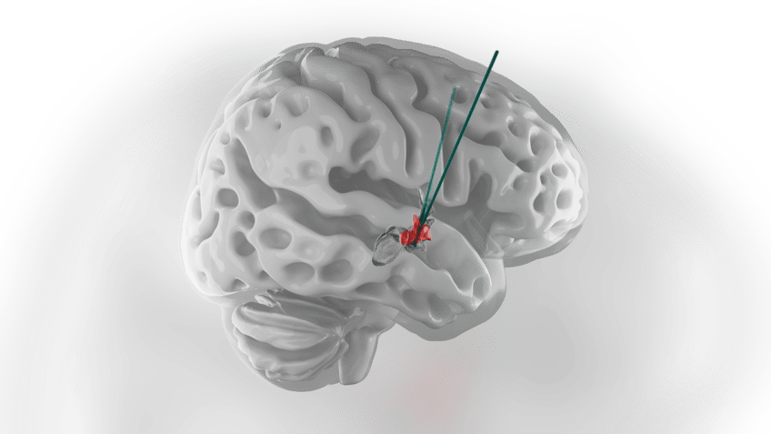 Hypothalamus