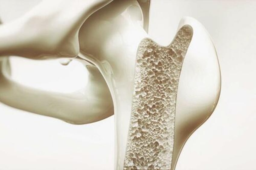 new hormone discovery unlocks hope for osteoporosis treatment