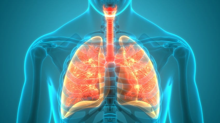 new lung cancer screening guidelines increase eligibility for high risk patients should you be screened