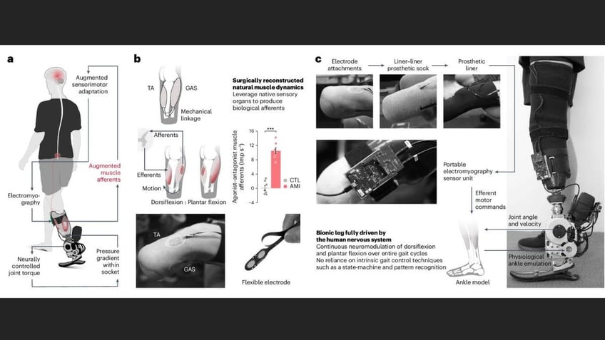 prosthetics 2