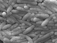 New salmonella outbreak is linked to backyard poultry, CDC says