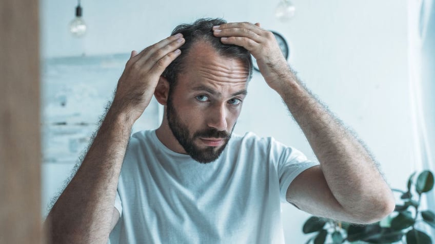 Man hair loss