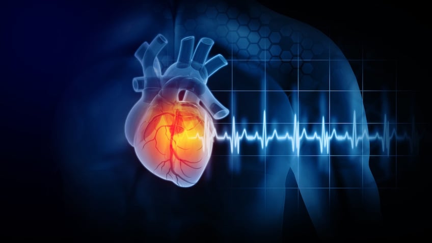 new tech has spooky ability to detect future heart attack study