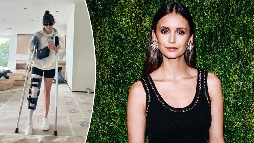 A split photo of Nina Dobrev and her injury