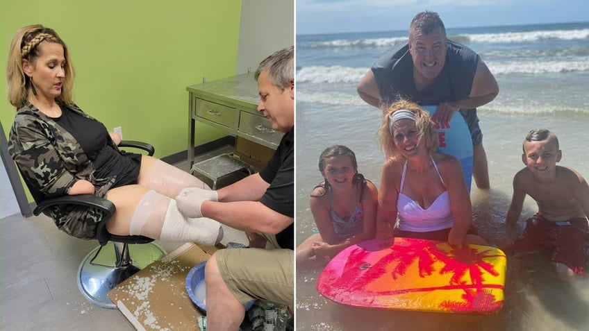 ohio woman who lost all four limbs to flu complications speaks out to raise awareness