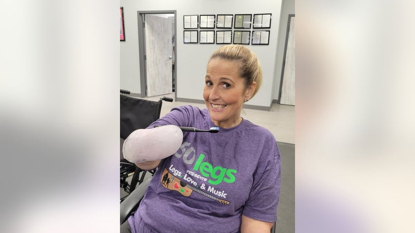 ohio woman who lost all four limbs to flu complications speaks out to raise awareness